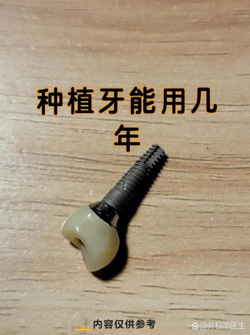 种植牙新趋势：让您的笑容更灿烂