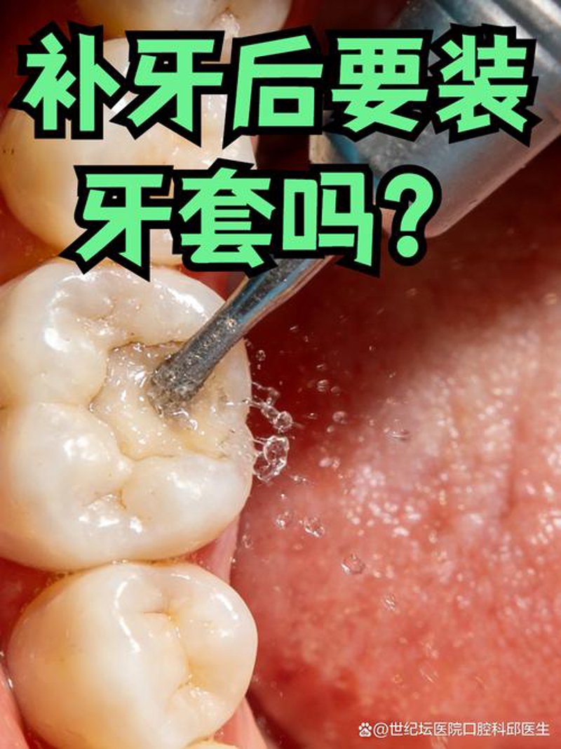 补牙
